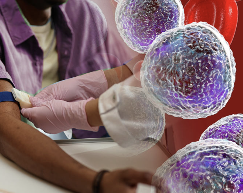 Patient received treatment for Leukemia